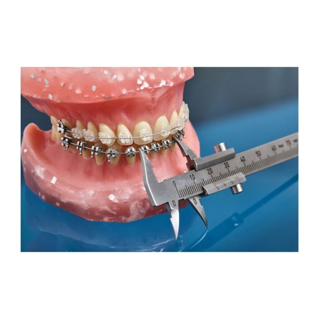 orthodontist consultation for adult braces metal and clear braces measure teeth